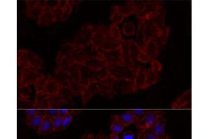 Immunofluorescence analysis of HeLa cells using KLRK1 Polyclonal Antibody at dilution of 1:100.