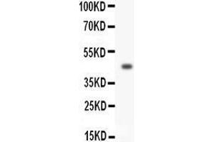 Image no. 1 for anti-Homeobox A3 (HOXA3) (AA 427-443), (C-Term) antibody (ABIN3044212)