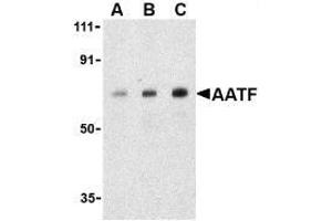 Image no. 2 for anti-Apoptosis Antagonizing Transcription Factor (AATF) antibody (ABIN499185)