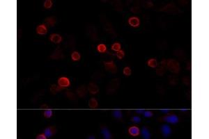 Immunofluorescence analysis of HeLa cells using FLNC Polyclonal Antibody at dilution of 1:100 (40x lens).