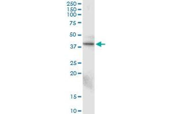 anti-Connective Tissue Growth Factor (CTGF) (AA 31-251) antibody