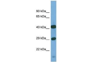 Image no. 1 for anti-N-Sulfoglucosamine Sulfohydrolase (SGSH) (C-Term) antibody (ABIN2783228)