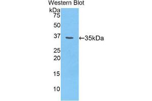 Image no. 1 for anti-Melanoma Associated Chondroitin Sulfate Proteoglycan (MCSP) (AA 1135-1444) antibody (ABIN1174256)