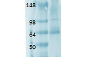 Image no. 3 for anti-Solute Carrier Family 5 (Sodium/iodide Cotransporter), Member 5 (SLC5A5) (AA 468-643) antibody (HRP) (ABIN2484459)
