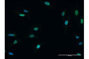 Immunofluorescence of purified MaxPab antibody to MCM5 on HeLa cell.