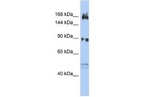Image no. 2 for anti-AF4/FMR2 Family, Member 2 (AFF2) (N-Term) antibody (ABIN2778348)