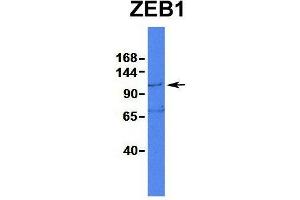 Image no. 5 for anti-Zinc Finger E-Box Binding Homeobox 1 (ZEB1) (N-Term) antibody (ABIN2779631)