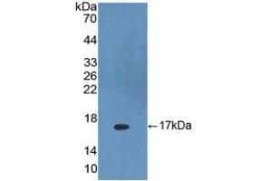 DKK4 Antikörper  (AA 107-212)