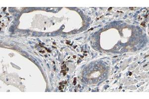 Image no. 2 for anti-USO1 Homolog, Vesicle Docking Protein (USO1) antibody (ABIN6266289)