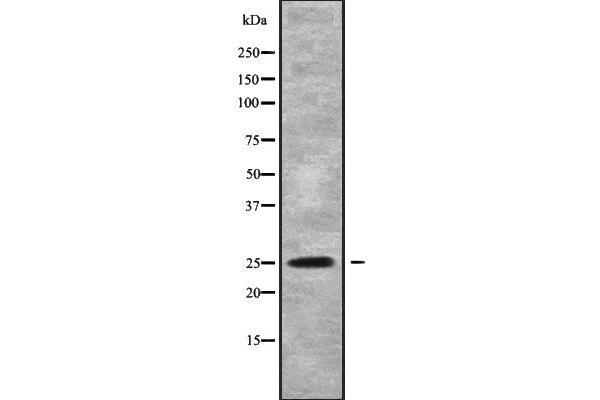 anti-Phosphatidylinositol Glycan F (PIGF) (Internal Region) antibody