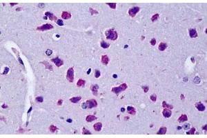 Image no. 1 for anti-Cylindromatosis (Turban Tumor Syndrome) (CYLD) (Internal Region) antibody (ABIN190823)