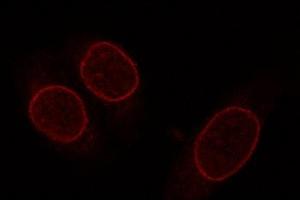 Image no. 2 for anti-Nucleoporin 153kDa (NUP153) (AA 1456-1475) antibody (ABIN7048098)