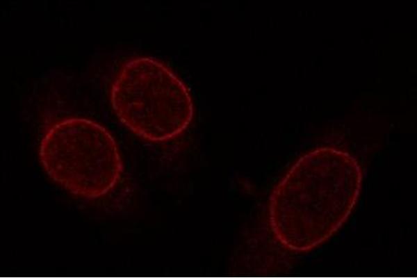 NUP153 Antikörper  (AA 1456-1475)