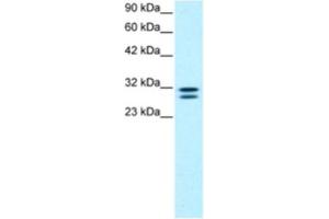 Image no. 1 for anti-HIV-1 Tat Interactive Protein 2, 30kDa (HTATIP2) antibody (ABIN2460567)