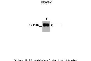 Image no. 1 for anti-Neuro-Oncological Ventral Antigen 2 (NOVA2) (N-Term) antibody (ABIN2778799)