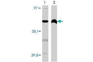 Image no. 1 for anti-Cytochrome P450, Family 4, Subfamily F, Polypeptide 11 (CYP4F11) antibody (ABIN533618)