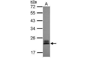 WB Image Sample (30 ug of whole cell lysate) A: A431 , 12% SDS PAGE antibody diluted at 1:3000