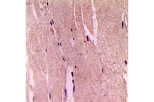 Image no. 1 for anti-Glycogen Synthase 1 (Muscle) (GYS1) (C-Term), (pSer645) antibody (ABIN2704870)