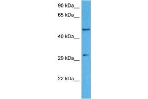 Image no. 4 for anti-Tryptophan 2,3-Dioxygenase (TDO2) (N-Term) antibody (ABIN2782334)