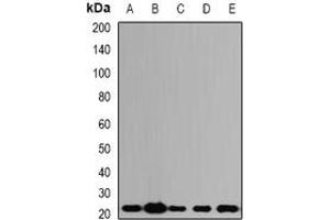 Image no. 3 for anti-Asparagine-Linked Glycosylation 2, alpha-1,3-Mannosyltransferase Homolog (ALG2) (full length) antibody (ABIN6005436)
