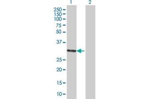 Image no. 1 for anti-General Transcription Factor IIF, Polypeptide 2, 30kDa (GTF2F2) (AA 1-249) antibody (ABIN516265)