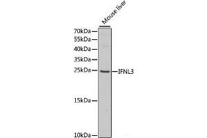 IL28B anticorps