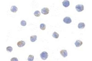 Image no. 2 for anti-ADAM Metallopeptidase Domain 10 (ADAM10) (AA 732-748) antibody (ABIN319033)