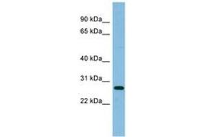 Image no. 1 for anti-Ribosomal Protein L10a (RPL10A) (AA 107-156) antibody (ABIN6745123)