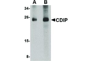 Image no. 1 for anti-LITAF-Like Protein (CDIP1) (Internal Region) antibody (ABIN6655960)