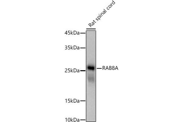 RAB8A Antikörper