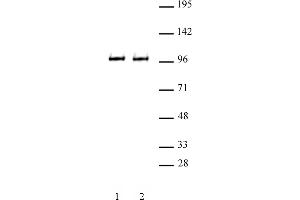 Image no. 1 for anti-Bromodomain Containing 3 (BRD3) (C-Term) antibody (ABIN6971459)