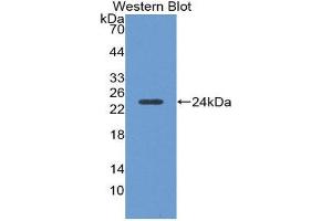 Image no. 1 for anti-Orosomucoid 1 (ORM1) (AA 2-171) antibody (ABIN1862077)