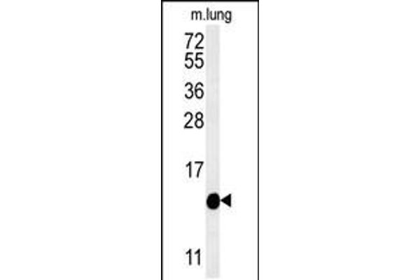 anti-Intraflagellar Transport 20 Homolog (IFT20) (AA 44-71) antibody