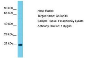 Image no. 1 for anti-Chromosome 12 Open Reading Frame 44 (C12orf44) (AA 29-78) antibody (ABIN6750653)