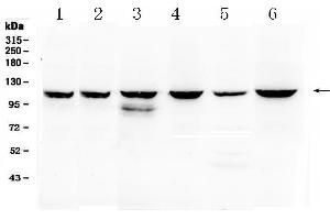 Image no. 1 for anti-Phosphoinositide-3-Kinase, Catalytic, beta Polypeptide (PIK3CB) (AA 556-598), (Middle Region) antibody (ABIN5518862)