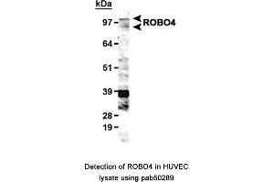 Image no. 1 for anti-Roundabout, Axon Guidance Receptor, Homolog 4 (ROBO4) (AA 900-1007), (C-Term) antibody (ABIN363598)