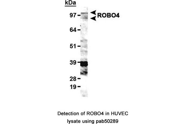 ROBO4 抗体  (C-Term)