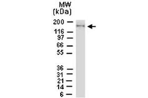 Image no. 2 for anti-NLR Family, Pyrin Domain Containing 1 (NLRP1) antibody (ABIN537414)