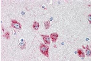 Image no. 2 for anti-Ankylosis, Progressive Homolog (Mouse) (ANKH) (AA 464-492) antibody (ABIN1892978)
