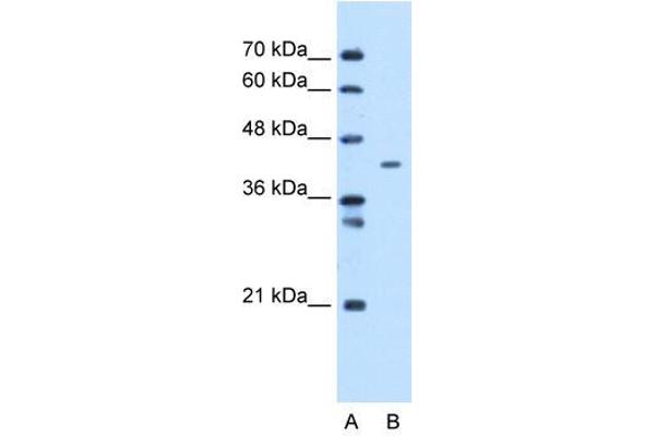 anti-Mitochondrial Carrier 1 (MTCH1) antibody