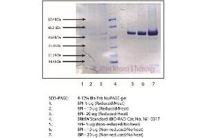Image no. 1 for Bactericidal/Permeability Increasing Protein (BPI) protein (ABIN3119664)