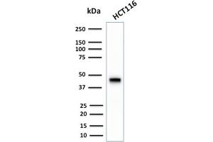 Image no. 1 for anti-Keratin 18 (KRT18) antibody (ABIN6939938)
