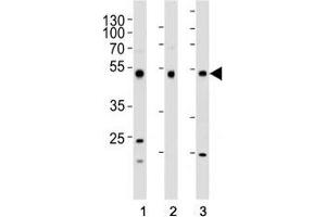 Western blot analysis of lysate from (1) HepG2, (2) HT-29, and (3) SW620 cell line using FOXA2 antibody at 1:1000.