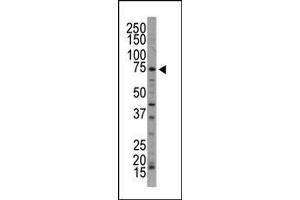 Image no. 1 for anti-NUAK Family, SNF1-Like Kinase, 1 (NUAK1) (AA 604-634), (C-Term) antibody (ABIN392640)