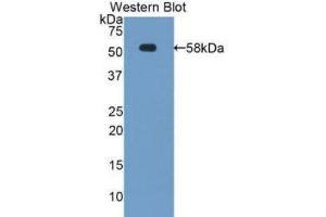 Image no. 1 for anti-Tissue Factor Pathway Inhibitor (Lipoprotein-Associated Coagulation Inhibitor) (TFPI) (AA 29-251) antibody (ABIN1860711)