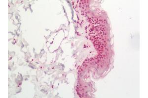 Human Skin: Formalin-Fixed, Paraffin-Embedded (FFPE).