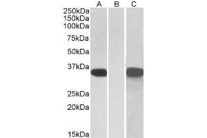 Image no. 2 for anti-Cysteine-Rich Secretory Protein 2 (CRISP2) (Internal Region) antibody (ABIN571121)