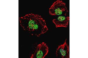 Image no. 4 for anti-Nucleolin (NCL) (AA 428-455) antibody (ABIN655626)