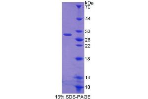Image no. 1 for Cysteine-Rich Secretory Protein 1 (CRISP1) (AA 20-246) protein (His tag) (ABIN6238963)