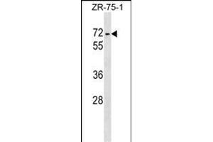ZKSCAN1 Antibody (Center) (ABIN1538154 and ABIN2848860) western blot analysis in ZR-75-1 cell line lysates (35 μg/lane).
